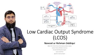 Identification and Management of Low Cardiac Output Syndrome LCOS  Dr Naveed ur Rehman [upl. by Mazonson532]