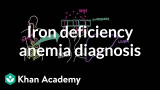 Iron deficency anemia diagnosis  Hematologic System Diseases  NCLEXRN  Khan Academy [upl. by Boleslaw236]