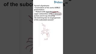 Coarctation of the Aorta for the USMLE  HyGuru [upl. by Yrral]