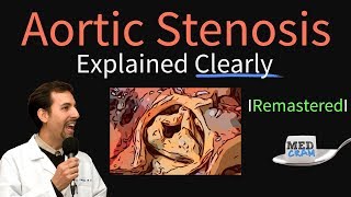 Aortic Stenosis Remastered Symptoms murmur aortic valve stenosis treatment [upl. by Torp294]