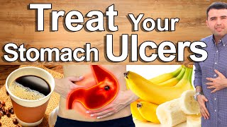 Do This And Cure Your Stomach Pain Gastritis and Ulcers  Best Natural Treatment of Stomach Pain [upl. by Hawker174]