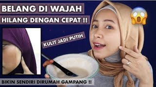 TIPS MENGHILANGKAN BELANG DI WAJAH amp MEMUTIHKAN KULIT DENGAN CEPAT MENGGUNAKAN BAHAN ALAMI [upl. by Trudey]