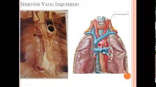 TEMA 10 ESTRUCTURA DEL MEDIASTINO [upl. by Pardo]