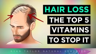 Top 5 Vitamins To PREVENT Hair Loss [upl. by Eatnad749]