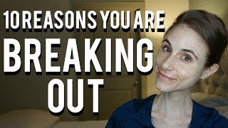 10 reasons why you are breaking out Dr Dray Vlogmas Day 17 [upl. by Robena481]