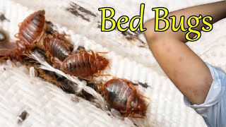 Bed Bugs Unseen Nightmares [upl. by Hardin]