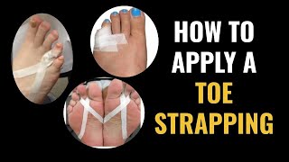 How Do I Do Toe Strapping Dislocated and Fractured Toe [upl. by Rebekkah]