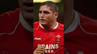 Welsh Rugby Star to Heart Transplant at 29 shorts [upl. by Akemal]