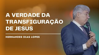 POR QUE A TRANSFIGURAÇÃO DE JESUS TRANSFORMA NOSSA FÉ  HERNANDES DIAS LOPES [upl. by Riedel399]