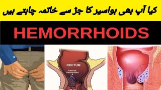 How To Get Rid Hemorrhoid [upl. by Wendie]