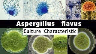 Aspergillus Flavus Culture Characteristic [upl. by Waers]