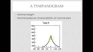 Tympanometry interpretation [upl. by Olracnaig]