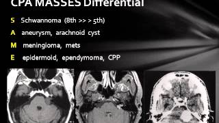 Cerebellopontine Angle Lesions [upl. by Robb]