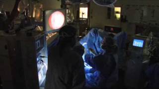 Holmium Laser for BPHMayo Clinic [upl. by Fulcher]