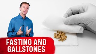 Fasting and Gallstones [upl. by Chane]