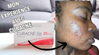 traitement médicamenteux de lacné sévère curacné 200mg [upl. by Eustatius94]