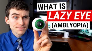 What is LAZY EYE Amblyopia and What Causes It [upl. by Sulecram322]