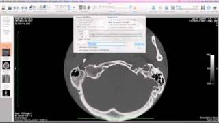 Using Osirix Part 2 [upl. by Enael407]