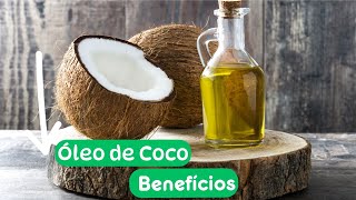 ÓLEO DE COCO  Seus Benefícios  Dr Prof Nelson Marques [upl. by Eatnoed430]