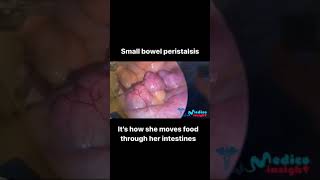 Small Bowel Peristalsis  Peristalsis  Bowel Movement  Bowel  Small Intestine [upl. by Marisa]