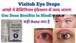 Visitob Eye Drops Use in Hindi आंखों के हर प्रकार की समस्या से तुरन्त आराम eyes drops antibiotic [upl. by Stag]