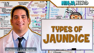 Gastrointestinal  Types of Jaundice [upl. by Koo]