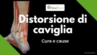 Distorsione di caviglia cura e cause [upl. by Secnarfyram]