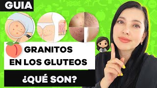 ¿Tienes GRANITOS en los GLÚTEOS TE CUENTO SOBRE FOLICULITIS [upl. by Melessa702]