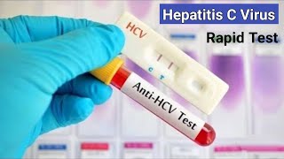 Hepatitis C Rapid Test  কিভাবে হেপাটাইটিসসি ভাইরাস পরীক্ষা করা হয়  AntiHCV RDT Test [upl. by Xonnel332]