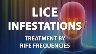 Lice Infestations Head  RIFE Frequencies Treatment  Energy amp Quantum Medicine with Bioresonance [upl. by Publius]