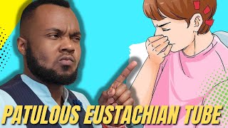 How to Heal Patulous Eustachian Tube Dysfunction [upl. by Anivid546]