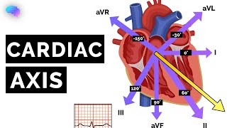 Cardiac Axis Explained  ECG  EKG  OSCE Guide  UKMLA  CPSA [upl. by Ninon]