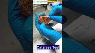 Catalase Test microbiology [upl. by Wilkey]