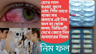 Nimphol or chloramphenicol eye ointment use for to reduce any common eye infection [upl. by Witherspoon975]