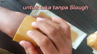 DuoDerm Extra Thin Apakah Bisa Untuk Luka Ca mamae  RaFer QnA [upl. by Anikehs]