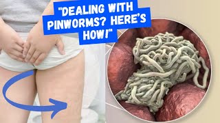 Pinworms Diagnosis Treatment and Prevention Tips [upl. by Kramal852]