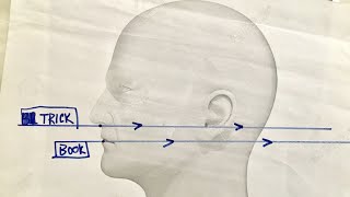 How To Take An Odontoid View XRay  Perfectly  Every Time [upl. by Milstone]