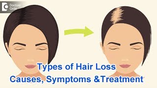 Types of Hair Loss  Common Causes Symptoms amp Treatment  Dr Kavitha GV Mandal [upl. by Rollet148]