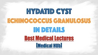 Hydatid cyst of Echinococcus granulosusDog tapeworm  Discussed in details everything you need [upl. by Carr404]