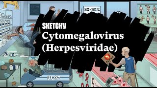 Understanding CytomegalovirusHerpes Virus Family Study Full Lesson Sketchy Medical USMLE Step 1 [upl. by Asirrac]