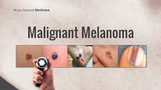 Malignant Melanoma [upl. by Maltzman]