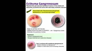 Ecthyma gangrenosum [upl. by Anyek]