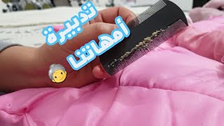 طريقة تنظيف قشور راس الرضيع بتدبيرة بسيطة و فعالة من عهد أمهاتنا💕 بومزيوف💕croûte de lait [upl. by Dysart]