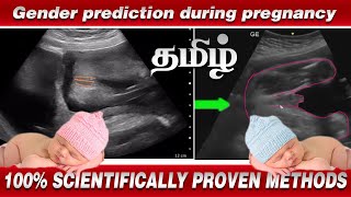 Gender prediction during pregnancy in Tamil  100 Scientific Proven Method  Nithya Arunkumar [upl. by Peace449]