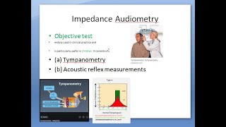 ENT 042 a Tympanometry Impedance Audiometry test Tympanogram [upl. by Tnecillim]