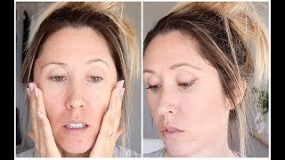 Get Ready With Me  Concealing Redness  Acne  Rosacea [upl. by Upton]