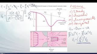 FM10 B1 Obstruction Flow Devices [upl. by Fai756]