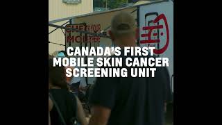 Mole Mobile  Canadas First Mobile Skin Cancer Screening Unit [upl. by Nilo]