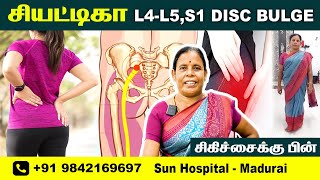 L4L5S1 DISC BULGE  FOOT NUMBNESS  Physiotherapy Treatment  RECOVERY  Sun Hospital Madurai [upl. by Kerrill]