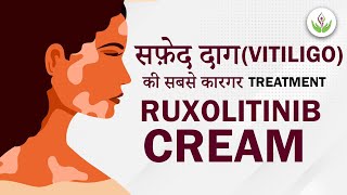 Ruxolitinib Cream  Latest Treatment For Vitiligo 2023  Care Well Medical Centre [upl. by Reinald]